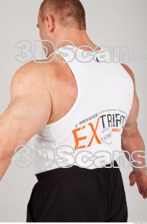 Singlet texture of Gene 0004